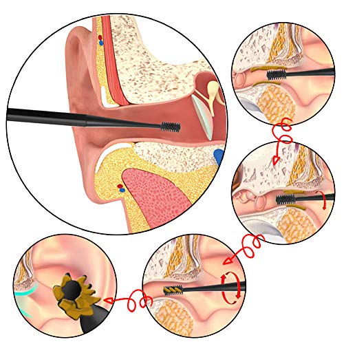 Limpiador de Oídos, Removedor de Cera de Oído, Ear Wax Removal, Ear Cleaner, Limpiador de oídos inteligente, para bebés, jóvenes y adolescentes adultos, 4 Pcs