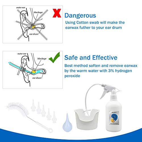 Limpiador de orejas, kit de irrigación del oído para lavar la cera del oído en el hogar, aliviar los oídos bloqueados/con picazón/dolor de oído para adultos y niños