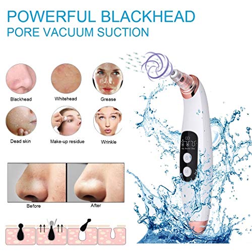 Limpiador de poros con 3 niveles de succión y 6 cabezales funcionales recargables USB