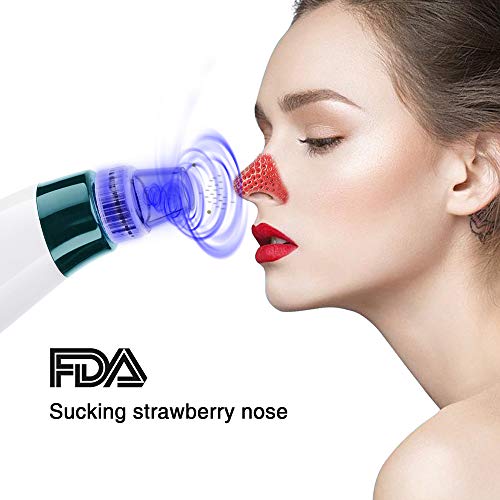 Limpiador de Poros, Eliminador de Punto Negro, 5 Sondas Multifuncionales Removedor de Espinillas Electrico para Eliminación de Espinillas y Acné Hembra Extractor Puntos Negros (Blue_eur remover)