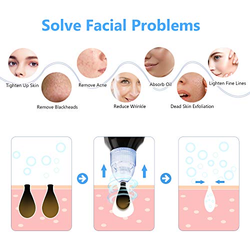 Limpiador de Poros, EWEIMA Limpiador Facial Electrico Extractor Puntos Negros Limpiador Facial Succionador de Puntos Negros USB Recargable con Pantalla LED, 4 Cabezales y 5 Modos