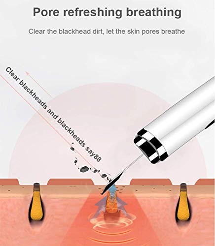 Limpiador Facial Piel, Exfoliador Poros Espátula Piel, Pantalla LCD Masajeador Levantamiento Facial EMS Con 4 Modos, Extractor Espinillas Extractor Peeling Comedones Para Limpieza Facial Profunda