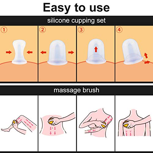 Macallen Conjunto de Ventosas Anticelulíticas con 3 Ventosas de Silicona y 1 Cepillo de Masaje, Ventosas de Vacío de Terapia Para Quemar Grasas y Cuidar el Cuerpo Azul