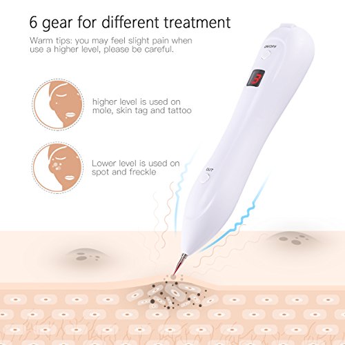 Manchas Cara Eliminación, iFanze Tratamientos para Manchas Piel y Manchas Faciales, Quita Pecas, Topo, Manchas, Tatuaje, Piel Tag, Nacimiento Marca, 2 Tipos de Agujas, Recargables por USB, Blanco