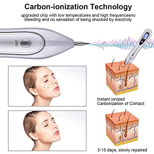 Manchas Cara Eliminación, Spot eraser pro, Quitar Verrugas Plasma Pen, Mole Removedor,Con Intensidad de 9 Niveles Pantalla LCD Manchas Cara Eliminación Manchita la Edad, Esputo, Pecas, Tatuajes