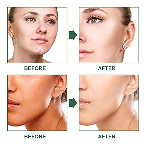 Mascarilla Exfoliante Facial, Mascarillas Limpiadoras, Mascarilla Hidratante, Tratamiento para el acné profundo Eliminador de blanqueamiento Máscara para dormir