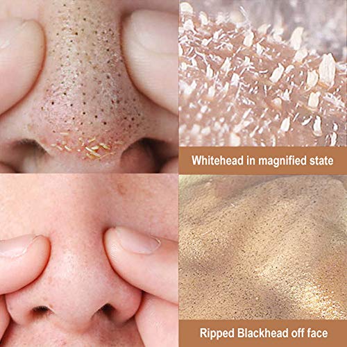 Mascarilla Exfoliante Facial, Puntos Negros Mascarilla, Peel Off Mascarillas, Mascarillas Exfoliantes y Limpiadoras, Purificante Espinillas y Piel Muerta, Hidratar Piel, Eliminar Puntos Negros, Acné
