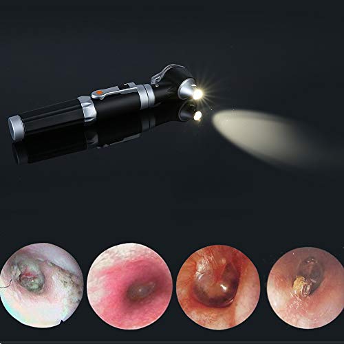 Mini Otoscopio, Bysameyee Magnificación Otoscopio de diagnóstico con luz de iluminación directa de LED, Herramienta para el oído saludable para doctores Enfermeras Adultos Niños Bebé Anciano Mascotas