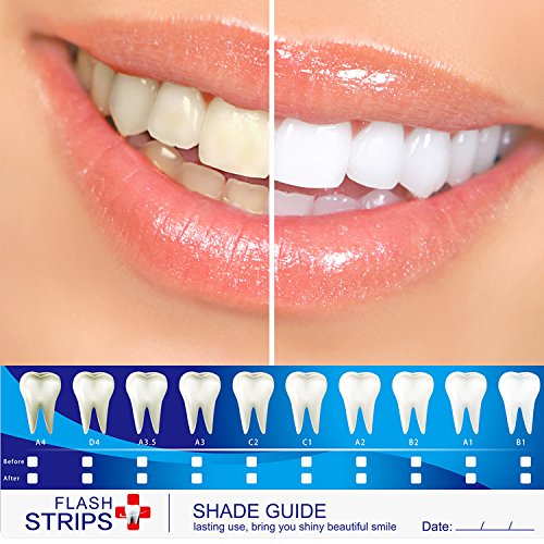MitButy Tiras Blanqueadoras de Dientes con Aceite de Coco Natural, 28 Tiras Blanqueadoras Antideslizantes – Tiras de Blanqueamiento Dental Profesionales con Efectos Seguros Para 14 Tratamientos