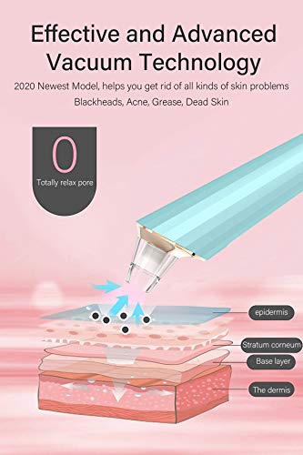 Moin Limpiador de Poros Limpiador Facial Electrónico Succionador de Puntos Negros Blackhead Remover Limpiador Poros USB Recargable con 4 Cabezales para Espinillas y Acné Kit Poros Negros Nariz