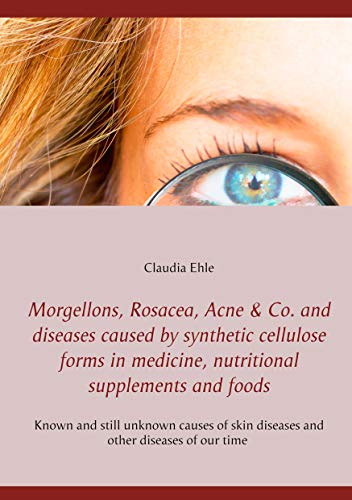 Morgellons, Rosacea, Acne & Co. and Diseases caused by synthetic cellulose forms in medicine, nutritional supplements and foods: Thoughts about old and new diseases of the skin (English Edition)