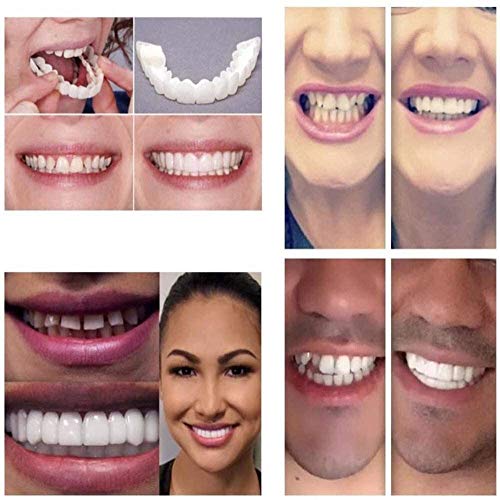 N\A AY Broche de presión en la Sonrisa carillas provisionales Prótesis Dental Reutilizable Invisible del Adulto Cubierta Dental Care Accesorios Blanco con Neat indolora sin sensibilidad fácil de Usar