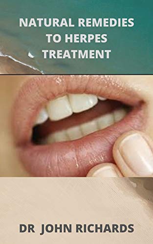 Natural Remedies for Herpes Treatment: The Complete Guide On Treating Herbs Naturally (English Edition)