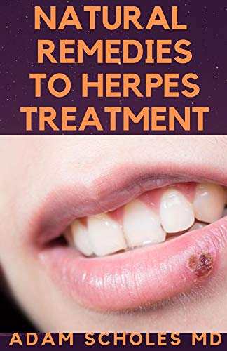 NATURAL  REMEDIES TO HERPES TREATMENT: The Complete Guide On Treating Herbs Naturally (English Edition)