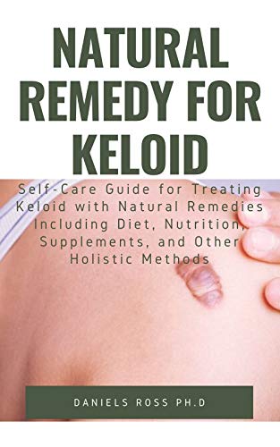 NATURAL REMEDY FOR KELOID: What Your Doctor Will Not Tell You and Secret of Living a Keloid Free Life (English Edition)