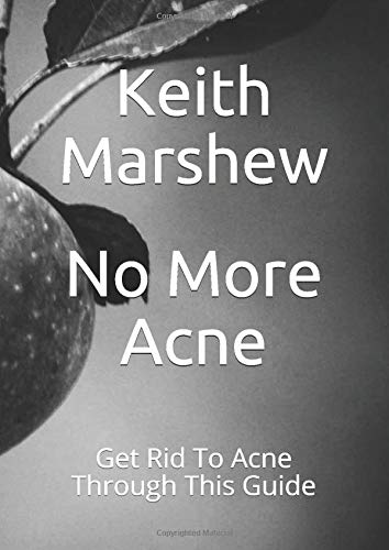 No More Acne: Get Rid To Acne Through This Guide
