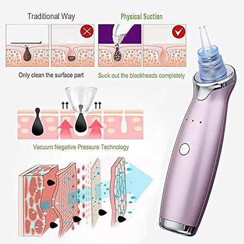 ONEVER Espinilla eléctrica recargable del removedor del acné del USB que quita los poros faciales que limpian el aparato