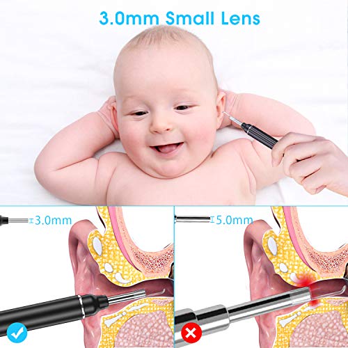 Otoscopio VITCOCO Endoscopio Camara Endoscopica 5MP Otoscopio WIFI 3mm con 6 LED Ajustables para iOS Android Tabletas