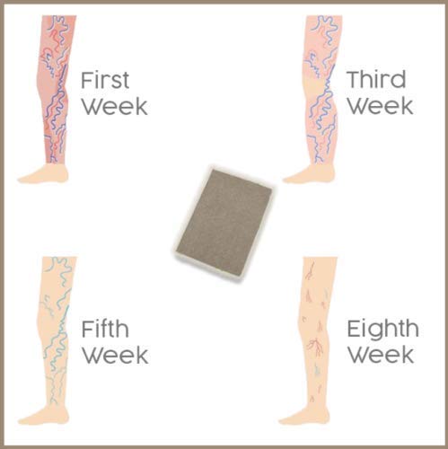 Parche de curación de hierbas varicosas, calidad original (12 unidades)