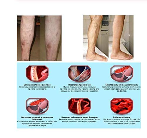 Parche de curación de hierbas varicosas, calidad original (12 unidades)