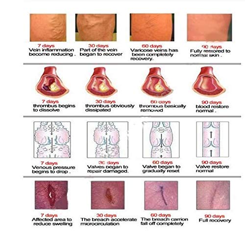 Parche de curación de hierbas varicosas, calidad original (12 unidades)