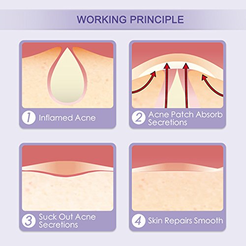 Parches Acne - Liberex 60pcs Parches Granos, Acné Hidrocoloide para Tratamiento de Espinilla, Φ12mm