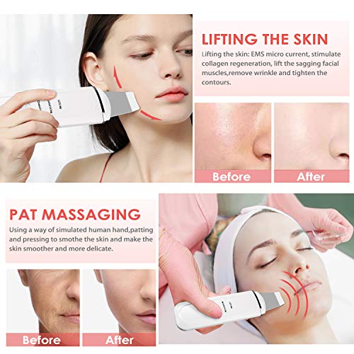 Peeling Ultrasónico Limpiador Facial Ultrasonico Facial Skin Scrubber para Eliminación de la Espinilla y Limpiador de Poros