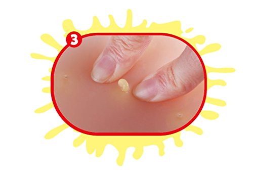 Pimple Popper Por ZURU