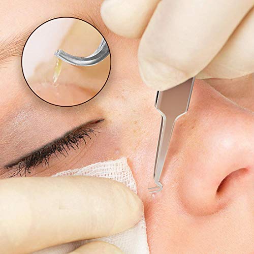 Pinzas de extracción de acné de espinilla negra - FEITA Pro y curva de acero inoxidable de grado quirúrgico Curva de comedón curvada Herramienta para eliminar puntas blancas y poros obstruidos