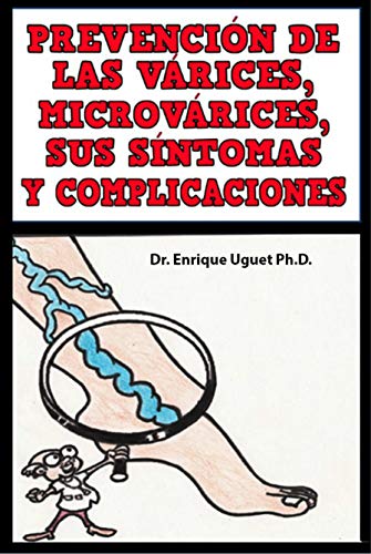 Prevencion de las Varices,  Microvarices, Sus sintomas y complicaciones: (B & W)