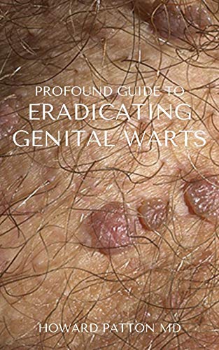 PROFOUND GUIDE TO ERADICATING GENITAL WARTS : The Effective Guide To Help You Destroy Your Existing Warts (English Edition)