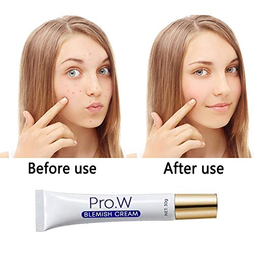 Pro.W Blemish Cream Skin Repair Ungüento Reduce el acné quístico, granos, manchas y cicatrices en la cara, espalda, cuerpo y glúteos