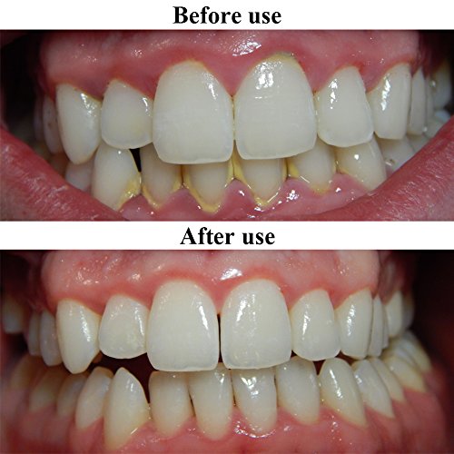 Púas de hilo dental Qivange, sin sabor, desechables y duraderas, hilo dental individual en 4 paquetes de 50 unidades (200 en total)