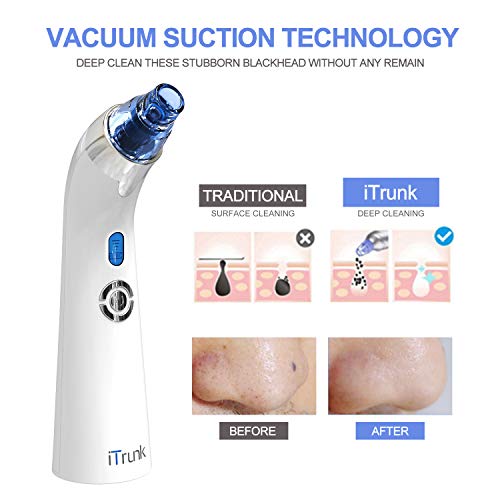 Puntos Negros Limpiador,Limpiador de Poros para comedones extractor puntos negros con 4 Sondas Multifuncionales,Aspirador Facial Recargable con Pantalla LED(Blanco)