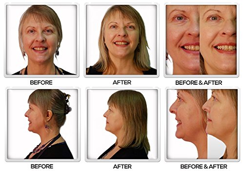 Rejuvenecedor facial - Infinity Tecnología ultrasonidos, 4 funciones, Antiarrugas, Anticelulítico, Anti estrias