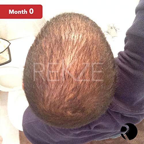 REKZE 63 Hair Growth Shampoo & Anti-Hair Loss Clinically Proven For Men & Women, For Thinning Hair, Thickening & ReGrowth, Strong DHT Blocker Product With Biotin, Emu Oil, Zinc, Caffeine