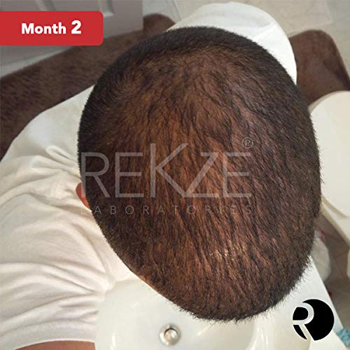 REKZE 63 Hair Growth Shampoo & Anti-Hair Loss Clinically Proven For Men & Women, For Thinning Hair, Thickening & ReGrowth, Strong DHT Blocker Product With Biotin, Emu Oil, Zinc, Caffeine