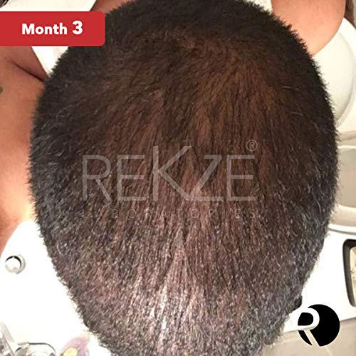 REKZE 63 Hair Growth Shampoo & Anti-Hair Loss Clinically Proven For Men & Women, For Thinning Hair, Thickening & ReGrowth, Strong DHT Blocker Product With Biotin, Emu Oil, Zinc, Caffeine