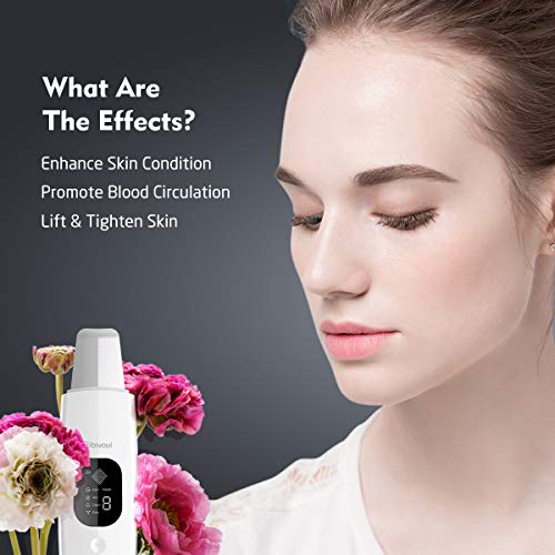 Ribivaul Skin Scrubber - Limpiador Facial Ultrasónico, Limpiador de Poros Espinillas Peeling Ultrasonico, Dispositivo Facial Exfoliante