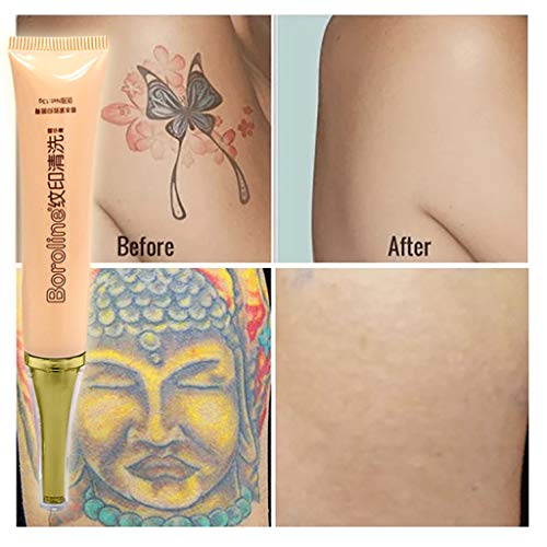 RISTHY Crema de Eliminación de Tatuajes - para Eliminar Tatuajes Que No Queremos - Crema para Borrar Tatuajes De Forma Efectiva, Segura E Indolora - Ocultar Tatuajes De Forma Segura