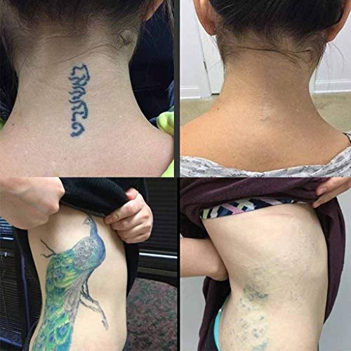 RISTHY Crema de Eliminación de Tatuajes - para Eliminar Tatuajes Que No Queremos - Crema para Borrar Tatuajes De Forma Efectiva, Segura E Indolora - Ocultar Tatuajes De Forma Segura