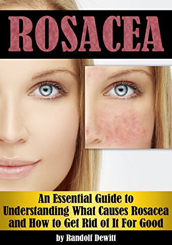 Rosacea: An Essential Guide to Understanding What Causes Rosacea and How to Get Rid of It For Good (English Edition)