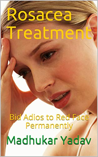 Rosacea Treatment: Bid Adios to Red Face Permanently (English Edition)