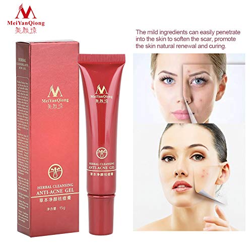 Rotekt 15g cicatriz natural para el acné marca removedor de espinilla removedor de gel tratamiento de manchas crema ungüento