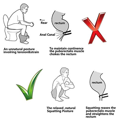 Rziioo Cuclillas WC Stool - Antideslizante Squatty IR al baño Cuarto de baño WC Taburete de Paso para los niños, Mujeres Embarazadas y Ancianos - Alivia el estreñimiento y distensión Abdominal,Azul