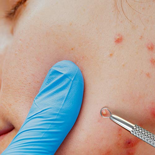 SC-1112 Suvorna Ador Skin Care Pimple Blemish Remover & Comedone Extractor with Needle Point Lancet