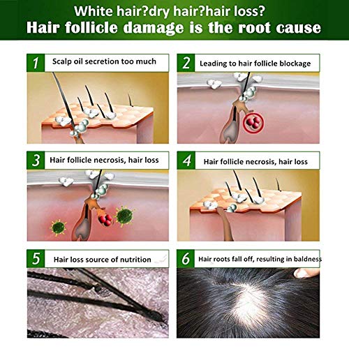 Sérum de crecimiento del cabello,Tratamiento para el Cabello,Antipérdida de Cabello,Promueve más Cabello Ticker,más Completo y más Rápido Crecimiento,Crece Pelo para Hombre y Mujer