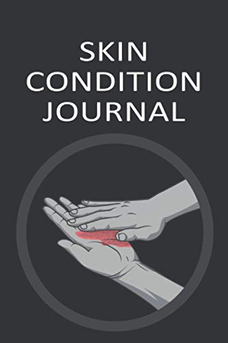 Skin Condition Journal: Blank Notebook For Tracking Skin Health Condition | Skin Problems Management & Treatment Log Book | Acne, Psoriasis, Eczema Logbook