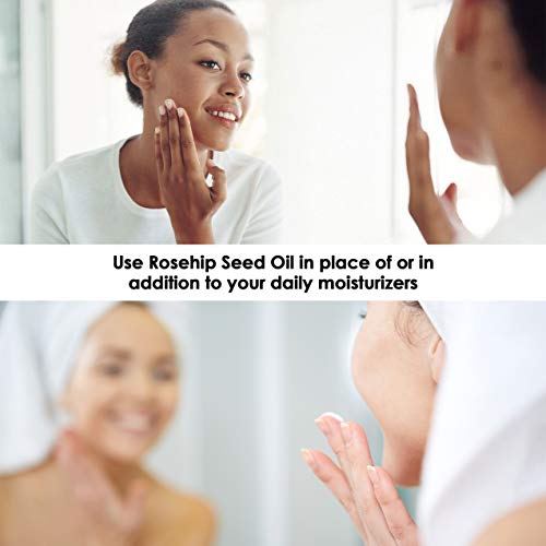 Sky Organics Orgánica aceite de rosa mosqueta, aceite de semilla de rosa mosqueta-Cruelty Free prensados ​​en frío, anti-envejecimiento facial aceite, aceite facial antioxidante, 100% puro