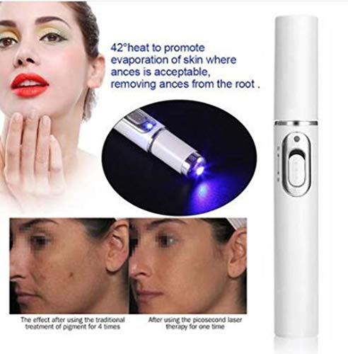 Spider Vein Eraser - Pluma Poderosa Para Eliminar Venas Contra Las Várices